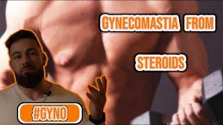 Gynecomastia from steroids - How to stop man boobs and why you get it.