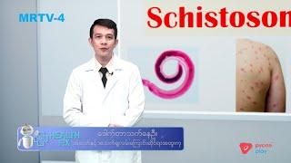 ရေချိုခရုမှ ကူးစက်သော သံပြားကောင်ရောဂါ | Health Fix | MRTV-4