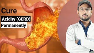 Acidity problem solution | acidity home remedies | Acid reflux treatment | acidity symptoms | GERD