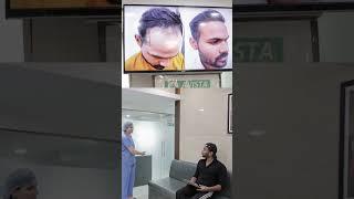 Saransh Universe Hair Transplant  #Hair transplant @saransh.universe