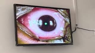 Envision Lasik centre
