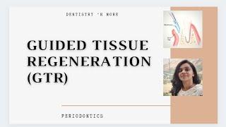 GTR (GUIDED TISSUE REGENERATION )