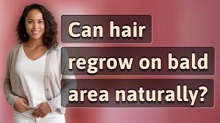 Can hair regrow on bald area naturally?