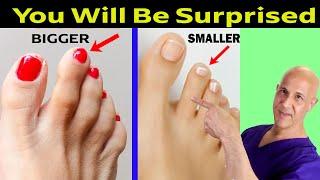 Look at Your 2nd Toe...This Secret Reveals Your Personality | Dr. Mandell