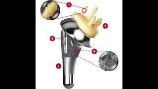 Anatomic Total Shoulder Replacement Education
