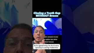 Closing a Front Tooth Gap WITHOUT Braces |  In Office to Hands On Dental Training