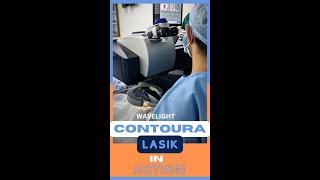 Wavelight Contoura Lasik In Action