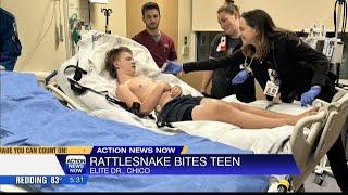 Chico teen recovering after being bitten by a rattlesnake over the weekend