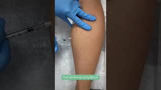 Calf Slimming Treatment by RN Ami - Ageless MD