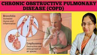 Chronic Obstructive Pulmonary Disease (COPD) | Chronic Bronchitis | Emphysema | Causes | Symptoms