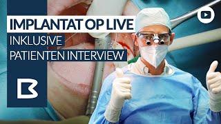 Zahnimplantat einsetzen? OP LIVE - inkl. Patienten INTERVIEW!