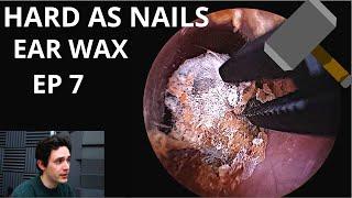 Hard As Nails Ear Wax EPISODE 7