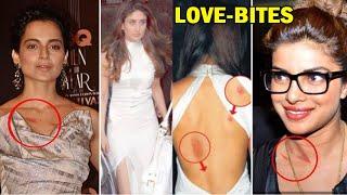 10 Bollywood Stars are Publicly Seen With Love Bites