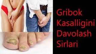 Gribok Kasalligini Davolash Sirlari | Гирибок Касаллигини Даволаш Сирлари