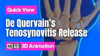 De Quervain’s Tenosynovitis Release // See How It Works // 3D Animation