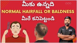 #AskDrJohnWatts | మీకు ఉన్నది Normal Hairfall or Baldness మీరే కనిపెట్టండి |Hair Specialist Explains