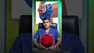 மூட்டுவலியா ? சூடு/ஐஸ் எந்த ஒத்தடம் எப்போது பயன்தரும்? #drarunkannan