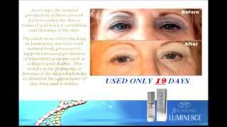 Jeunesse Luminesce Stem Cell Skin care Before and After Pictures