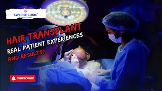 Real Patient Experiences and Hair Transplant Results!