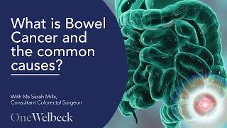 What is Bowel Cancer, what causes it and how can I help prevent it? | OneWelbeck Digestive Health