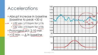 Learn OB/GYN: Fetal Heart Rate Monitoring / Nonstress Test