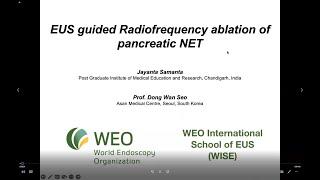 EUS guided Radiofrequency ablation of pancreatic NET