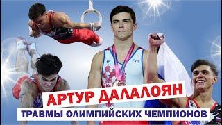 Травмы олимпийских чемпионов — спортивный гимнаст Артур Далалоян