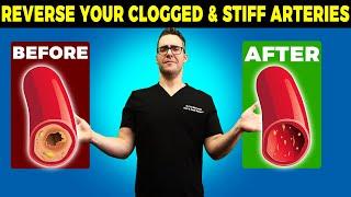 REVERSE Your Clogged & Stiff Arteries [50% Atherosclerosis over 45!]