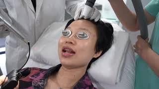 Điều Trị Tàn Nhang Tại Daimec Hải Phòng - Treatment For Freckles With Picoway Laser