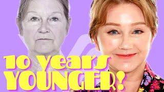 10 YEARS YOUNGER! Anti-Aging surgery in Korea | Docfinderkorea X Kat Wonders