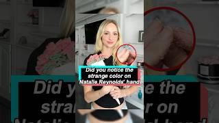 Did you notice the strange color on Natalie Reynolds' hand? This is the reason why Brooke Monk