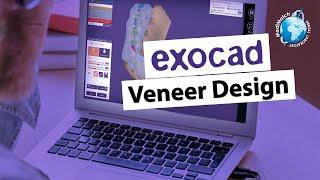 Exocad Veneer Design in minutes