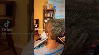 ALOPECIA HAIRLOSS NO WORRIES! YOU CAN STILL WEAR BEAUTIFUL HAIRSTYLES!