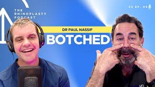 Botched with Dr Paul Nassif | The Rhinoplasty Podcast