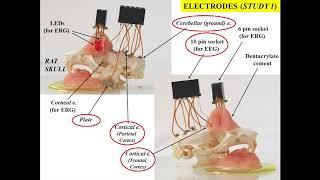 Zsolt Kovács, Ph.D.: Effect of Ketone Supplementation on Absence Seizures and Anxiety in Rats