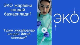 ЭКО (пункция) кандай инструментлар билан бажарилади? Кандай килиб тухум хужайралаб йигиб олинади?