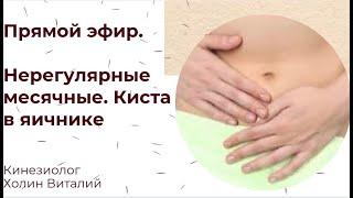 Прямой эфир. Нерегулярные месячные. Киста в яичнике