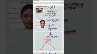 ophthalmology (AK khurana) #shortsfeed #newmusic #shortsvideo