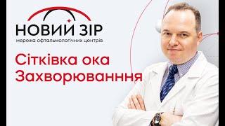 Що потрібно знати про сітківку ока? Хвороби сітківки та їх запобігання.