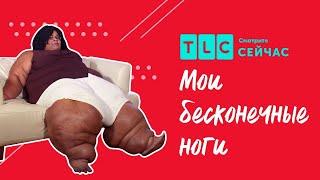 Вдохновляющий пример | Мои бесконечные ноги | TLC