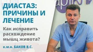 Диастаз – расхождение прямых мышц живота. Причины и способы лечения