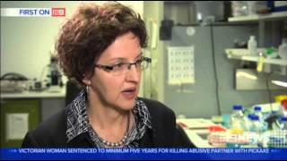 Understanding corpus callosum malformations | 9 News