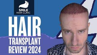 Smile Hair Clinic Istanbul - Full Review Experience 2024