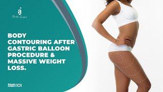BODY CONTOURING AFTER GASTRIC BALLOON PROCEDURE & MASSIVE WEIGHT LOSS - AJ Plastic Surgery Center