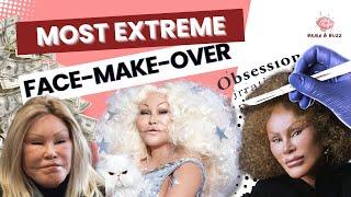  The Billionaire Catwoman: Beauty Obsession, Betrayal & Psychological Breakdown | Brain & Buzz