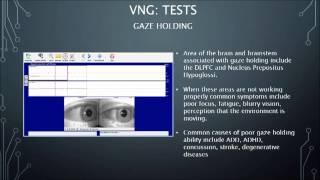 Videonystagmography (VNG) Intro