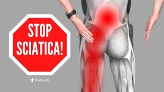 How to Relieve Sciatica Pain in SECONDS