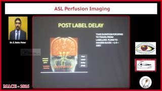 Tralier ASL Perfusion Imaging