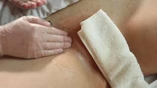 Vajacial San Diego | Vagina Facial (Vulva) | Ingrown Hair Skin Treatment