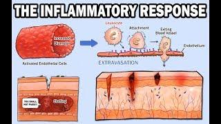 THE INFLAMMATORY RESPONSE